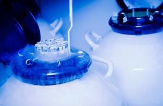 超低冷凍存儲(chǔ) 超低冷凍存儲(chǔ)